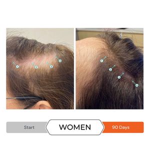 image-f7ea2b43b6f24222a0e343bb053a939d image-f7ea2b43b6f24222a0e343bb053a939d