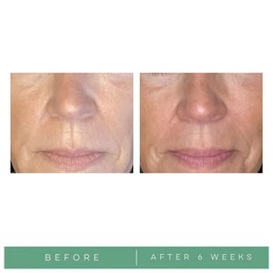 image-d1fd915e8eb8497d894d5dd9c2612fa3 image-d1fd915e8eb8497d894d5dd9c2612fa3